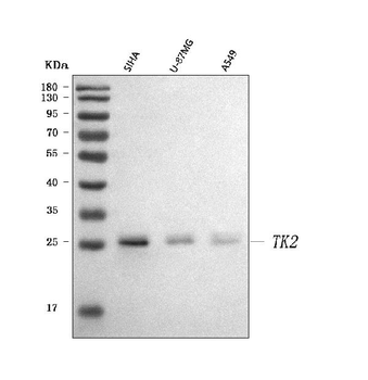Anti-Thymidine Kinase 2/TK2 Antibody