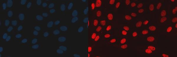 Anti-BAF57/SMARCE1 Antibody