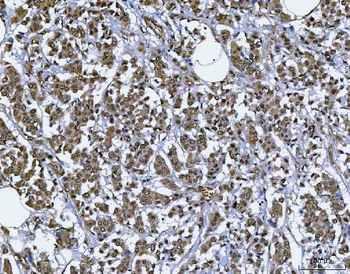 Anti-BAF57/SMARCE1 Antibody