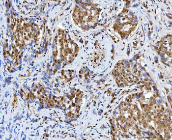 Anti-BAF57/SMARCE1 Antibody