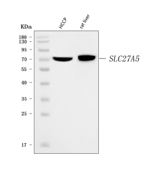 Anti-BAL/SLC27A5 Antibody