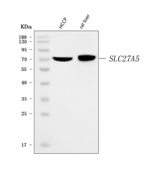 BAL/SLC27A5 Antibody