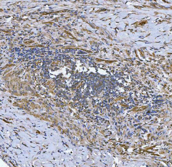 Anti-NHERF-2/SIP-1/SLC9A3R2 Antibody