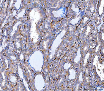 Anti-NHERF-2/SIP-1/SLC9A3R2 Antibody