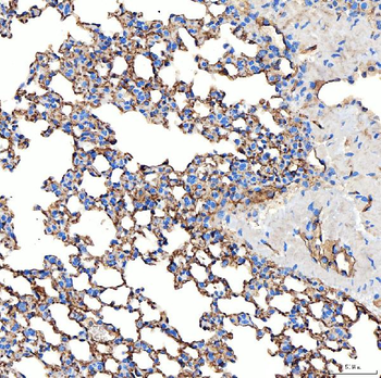 Anti-NHERF-2/SIP-1/SLC9A3R2 Antibody