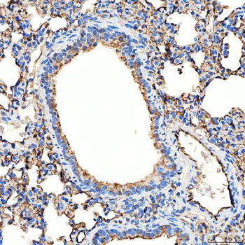 Anti-NHERF-2/SIP-1/SLC9A3R2 Antibody