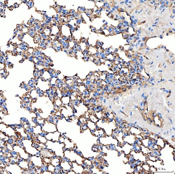 NHERF-2/SIP-1/SLC9A3R2 Antibody