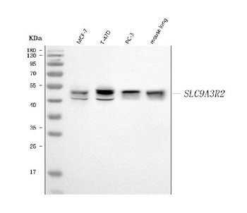 NHERF-2/SIP-1/SLC9A3R2 Antibody