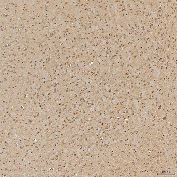 Anti-SINHCAF Antibody