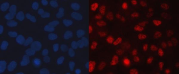 Anti-SINHCAF Antibody