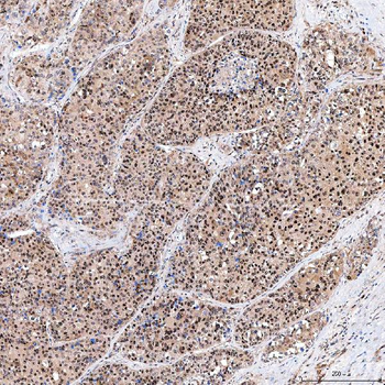 Anti-SINHCAF Antibody