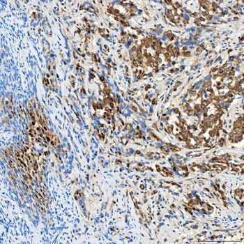Anti-SINHCAF Antibody