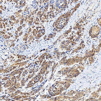 Anti-SINHCAF Antibody
