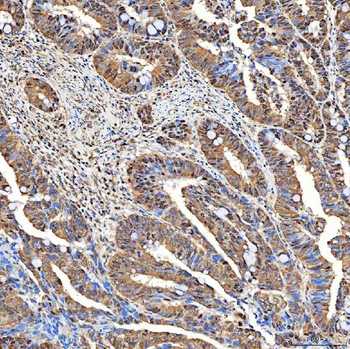 Anti-SINHCAF Antibody
