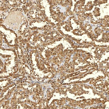 Anti-SINHCAF Antibody
