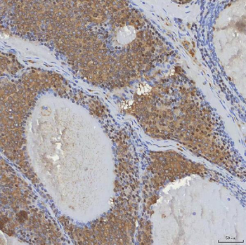 Anti-mSin3A/SIN3A Antibody