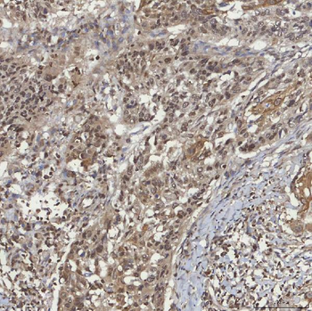 Anti-mSin3A/SIN3A Antibody