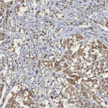 Anti-mSin3A/SIN3A Antibody
