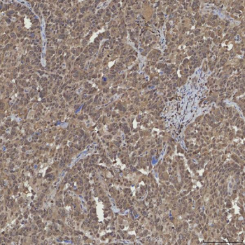 Anti-mSin3A/SIN3A Antibody