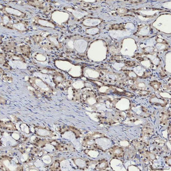 Anti-mSin3A/SIN3A Antibody