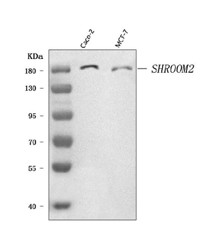 Anti-SHROOM2 Antibody