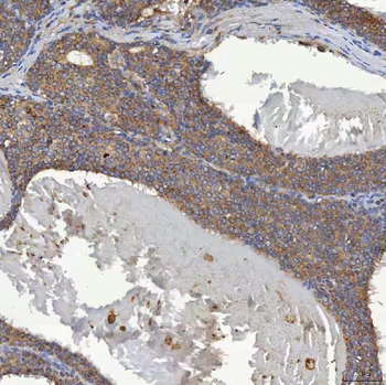 Anti-SHQ1 Antibody