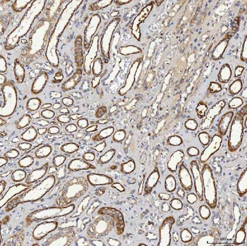 Anti-SHQ1 Antibody