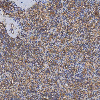 Anti-SHQ1 Antibody