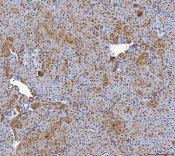 Anti-SHQ1 Antibody