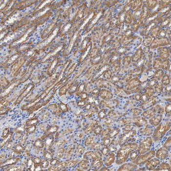 Anti-SHQ1 Antibody