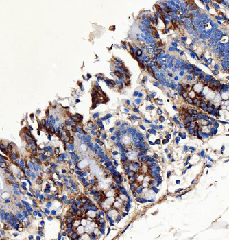 Anti-SH2D4A Antibody