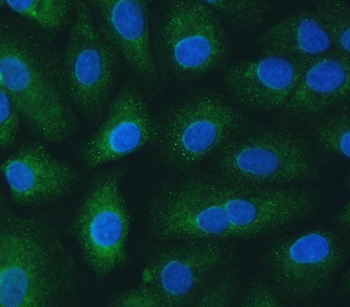 Anti-SH2D4A Antibody