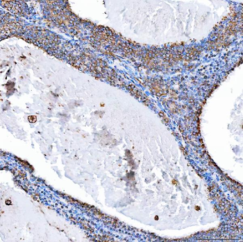 Anti-SH2D4A Antibody