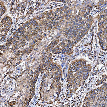 Anti-SH2D4A Antibody