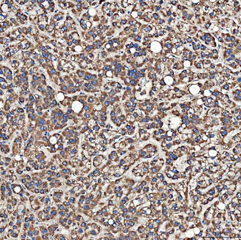 Anti-SH2D4A Antibody