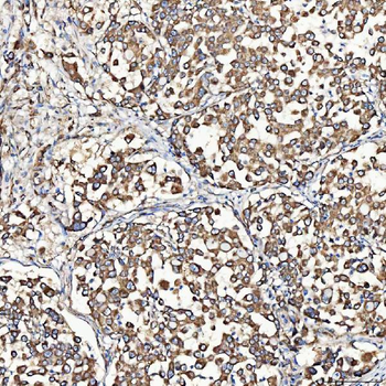 Anti-SH2D4A Antibody