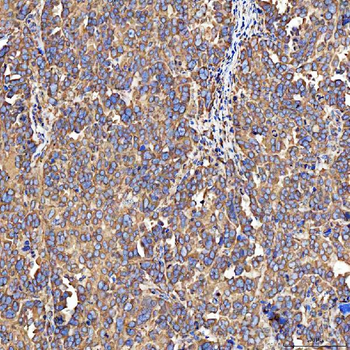 Anti-SH2D4A Antibody