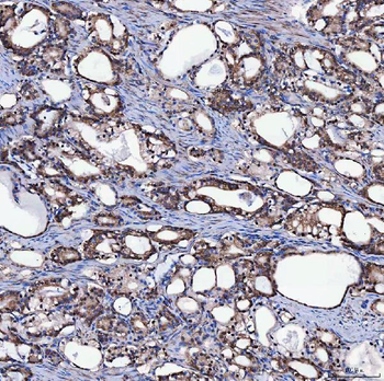 Anti-SH2D4A Antibody