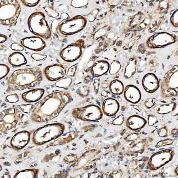 Anti-SH2D4A Antibody
