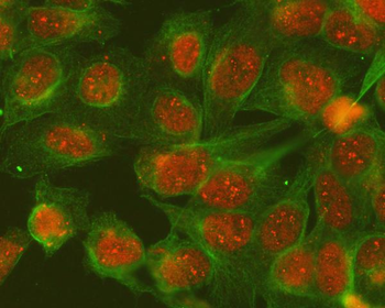 Anti-SGTA Antibody