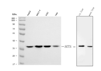 Anti-SGTA Antibody