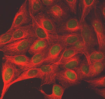 Anti-SGO2 Antibody