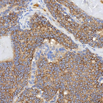 Anti-SGCE Antibody