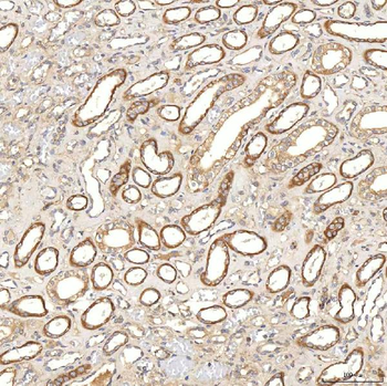 Anti-SGCE Antibody