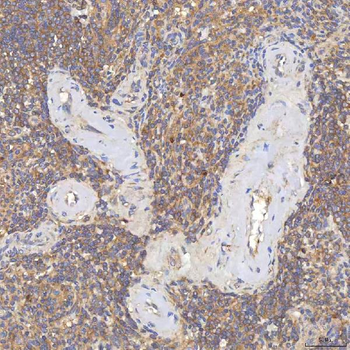Anti-SGCE Antibody