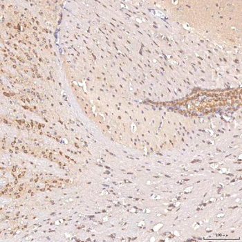 Anti-SGCE Antibody