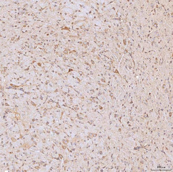 Anti-SGCE Antibody
