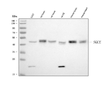 Anti-SGCE Antibody