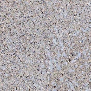 Anti-SFXN5 Antibody