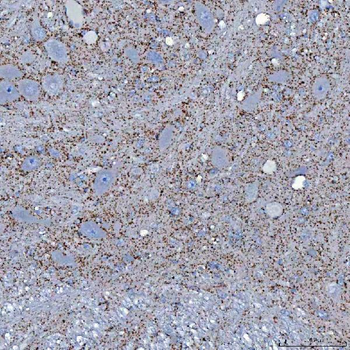 Anti-SFXN5 Antibody